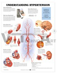 Understanding Hypertension Anatomical Chart